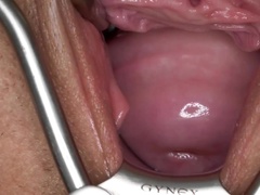 Inside valentina Sierra - gynaecological fetish, spatula close up